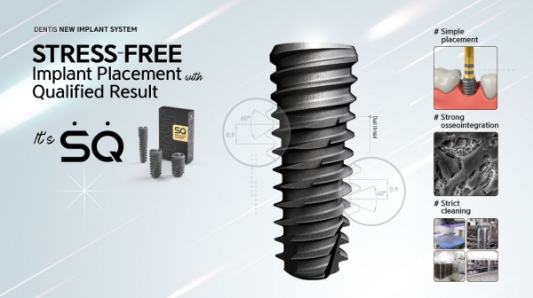 덴티스의 주가는 지난해 7월3일에 코스닥 상장된 직후 8000~9000원대 안팎에서 움직이다가 올해 2월에 1만원대에 진입했다. 사진은 덴티스의 대표적인 임플란트 픽스쳐 제품 SG. [사진 출처=덴티스]
