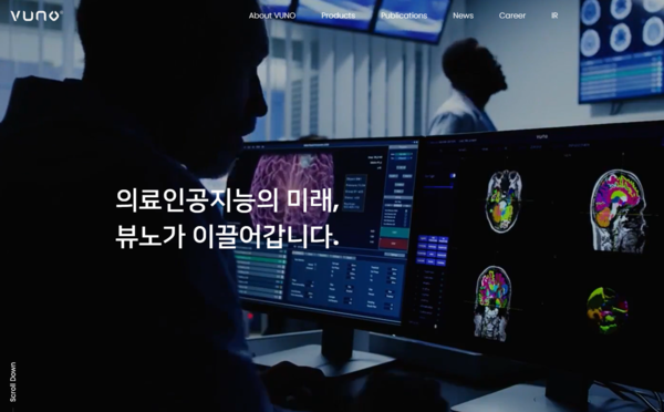 뷰노는 2014년 12월에 설립된 의료 인공지능(AI) 전문기업이다. 지난해 2월 코스닥 시장에 기술특례로 상장했다. 뷰노는 딥러닝 기술을 기반으로 의료 현장에서 의료영상, 생체신호 등에 근거한 의료진의 진단행위를 보조한다. 진단시간을 단축시키거나 새로운 진단과 예측기술 솔루션을 개발하는 사업을 영위하고 있다. [사진출처=뷰노]