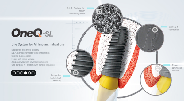 2005년 설립된 덴티스는 치과용 임플란트 제품 및 의료용 조명등, 치과용 3D프린터, 바이오 등을 개발, 생산, 판매하는 메디컬 솔루션 기업이다. [사진출처=덴티스]