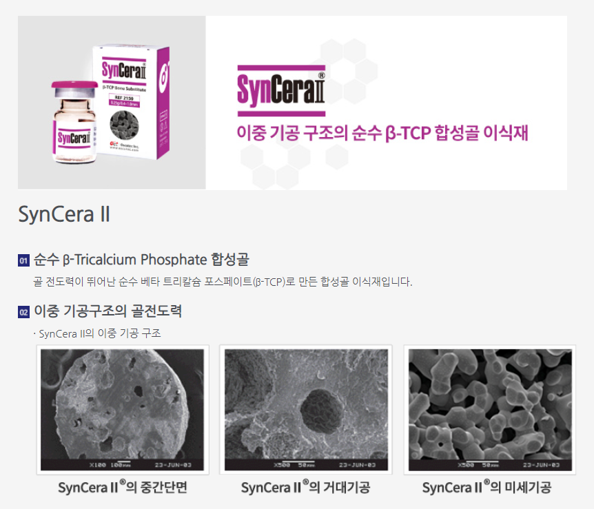 오스코텍은 1998년 12월 설립했고 2007년 1월 코스닥 시장에 상장했다. 오스코텍은 연구중심의 바이오 기업으로서 창사 이래 관절염, 항암제 등과 관련된 질병의 신약개발에 주력해왔다. 사진은 치과용뼈이식재 관련 제품. [사진출처=오스코텍] 