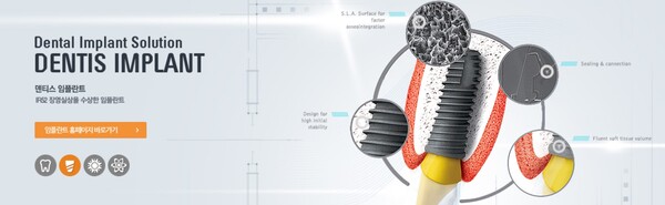 덴티스는 치과용 임플란트 제품을 주력으로 하고 있으며 보철, 시술 기구를 포함하는 치과용 의료기기와 생체재료, 치과용 3D 프린터 및 수술 등을 개발, 생산 및 판매하는 기업이다. [사진출처=덴티스]